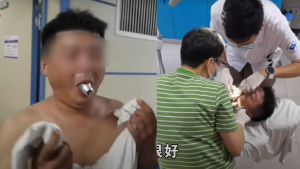 Influenciador terminó en el hospital por tratar de cumplir un reto viral