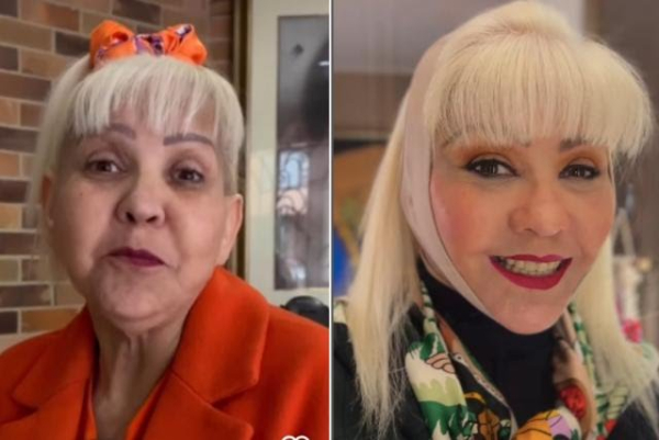 ‘Veo lo que yo quería ver’: la Gorda Fabiola tras su cirugía en el rostro